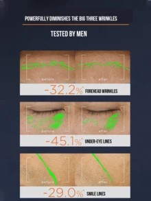 LOREAL 15/50ml Men's Expert Anti-Wrinkle Cream, Formulated With Boswellia And Peptides, Effectively Reduces Forehead Wrinkles By 32.2%, Under-Eye Fine Lines By 45.1%, And Nasolabial Folds By 29.0%, Fast-Absorbing, Lightweight, Non-Greasy, Non-Sticky, Suitable For Men's Daily Skincare. - Men's Youthful Skin Lightening Cream - View 5