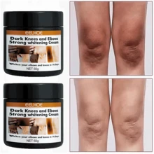 50ml Body Whitening Cream,Lightening Cream For Underarms And Inner Thighs For Body,Remove Dullness & Moisturizing Skin,For Body, Private Parts, Underarm Rejuvenating, Illuminating Butt Thigh Inner Skin - trắng - Xem 7