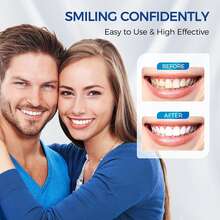 200mAh Battery-Powered LED Teeth Whitening Accelerator - Wireless Blue Light, Professional Teeth Whitening Tool And Accessories