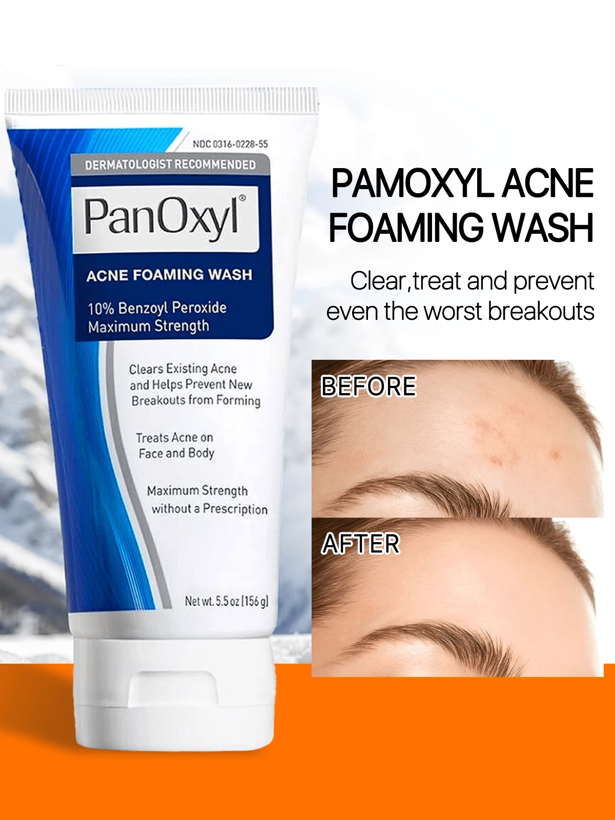 PanOxyl 痤疮泡沫洗面奶 过氧化苯甲酰 10% 洁面乳 3 盎司/85 克 痤疮护理 深层清洁 控油 强效 女朋友 妻子 母亲 朋友 男朋友 丈夫 父亲 兄弟 生日 毕业派对 旅行 露营 户外 学校 校园旅行 节日 夏季 秋季 秋季 美容 家居 夏季精选 夏季必备品 夏季经典 极简主义 V2 少即是多 - 彩色 - 查看 1