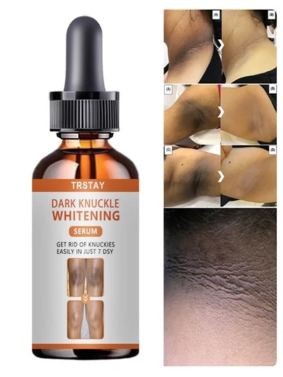 Moisturizing Body Essence, Mild And Non Irritating, Used In The Morning And Evening, Not Greasy.