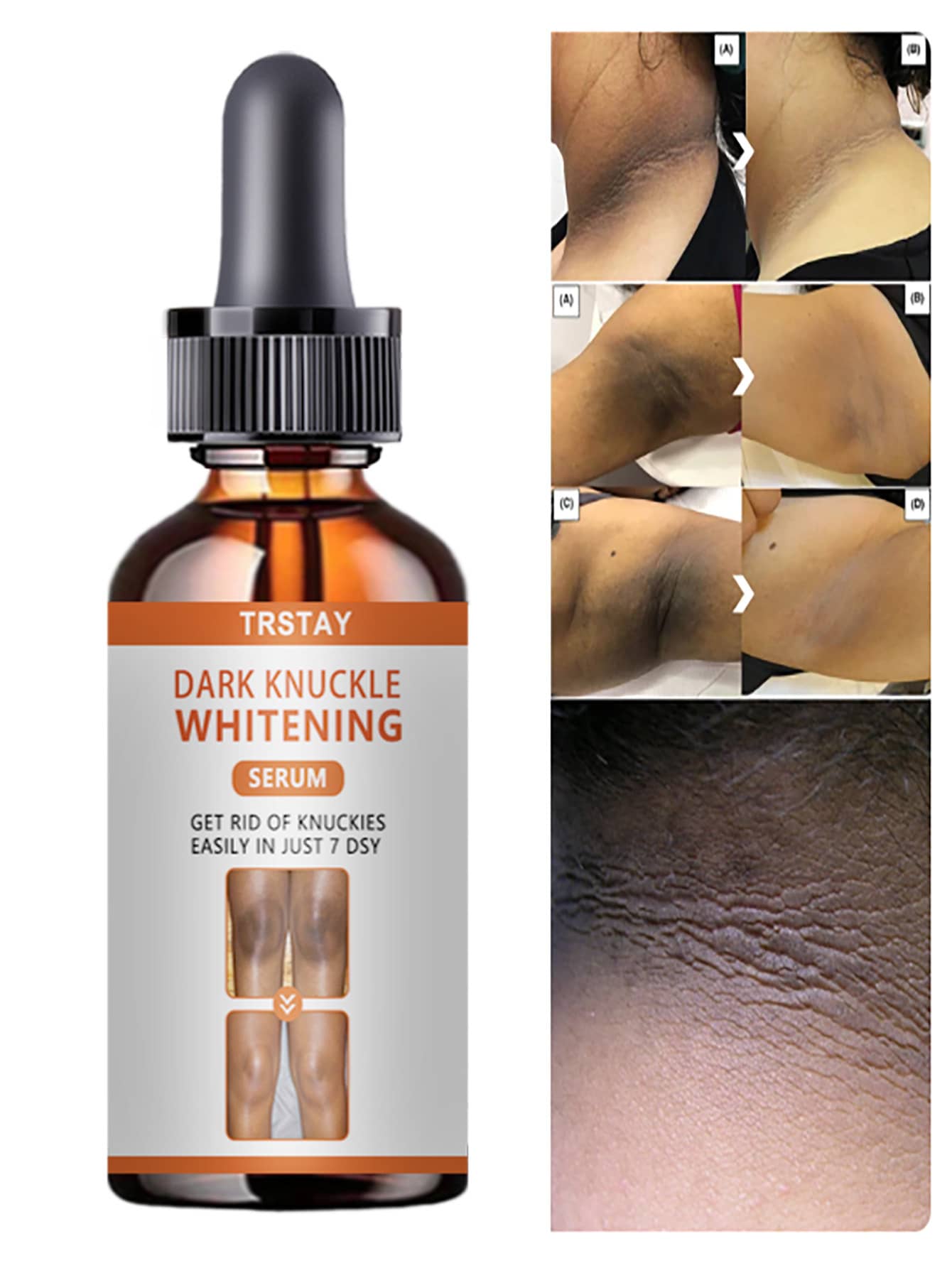 Moisturizing Body Essence, Mild And Non Irritating, Used In The Morning And Evening, Not Greasy. - Multicolor - View 1