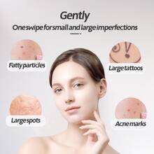 Skin Tag Remover Black Dots Blemish Laser Plasma Pen Mole Wart Eliminator Freckle Dark Spots Removal LCD Display 9 Levels - 白色 - 查看 9