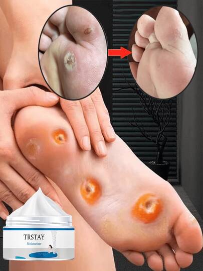 Moisturizing Foot Cream - Deeply Hydrates, An Essential Product For Maintaining Smooth Feet