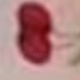 Mini cereza