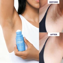 3-Piece Set,Razor Bump Stopper Roll-On, Dark Spot Remover & Ingrown Hair Treatment For Men & Women, No Bump After Shave Serum For Bikini, Face, Neck, Underarms & Legs-Valentines Gifts,Birthday,Gifts For Women,Mardi Gras - 淺藍色 - 查看 1