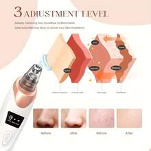 Electric Blackhead Remover, USB Charging, 5 Suction Tips And 3 Adjustable Gears, Electric Acne Removal Tool, Suitable For Both Women And Men, As A Gift For Women - 白金 - 查看 5