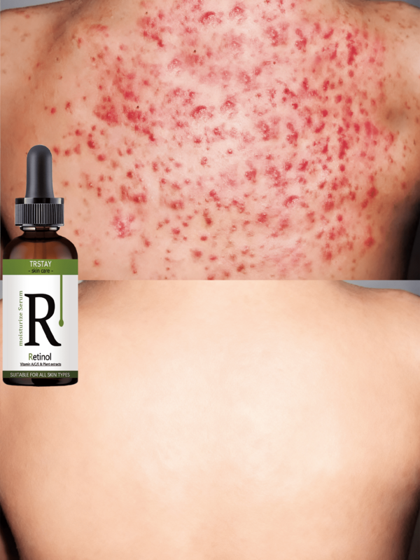 24-Hour Body Moisturizing Essence (Body Moisturizer) With Gentle Plant Extract Ingredients Relieves Dryness And Roughness, Keeps The Skin Soft, And Is Suitable For Sensitive Skin.