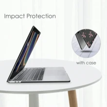 蝴蝶结图案笔记本电脑保护套，兼容苹果笔记本电脑，坚固耐用的塑料硬壳保护套，专业级保护壳。（黑色） - 蝴蝶結 - 查看 6