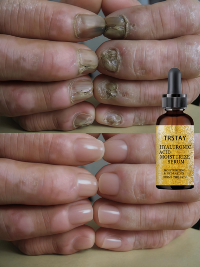TRSTAY Nail Care Serum - Helps Maintain Healthy Nails & Protects Against Damage
