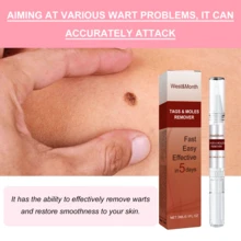 2 Pc Lápiz de piel líquido - eliminador/eliminación física de partículas de carne/removedor de verrugas/eliminación no invasiva, Diseño Compacto, Cuidado del Pie - Para Hombres y Mujeres, Aplicación Fácil - Rojo - Ver 4