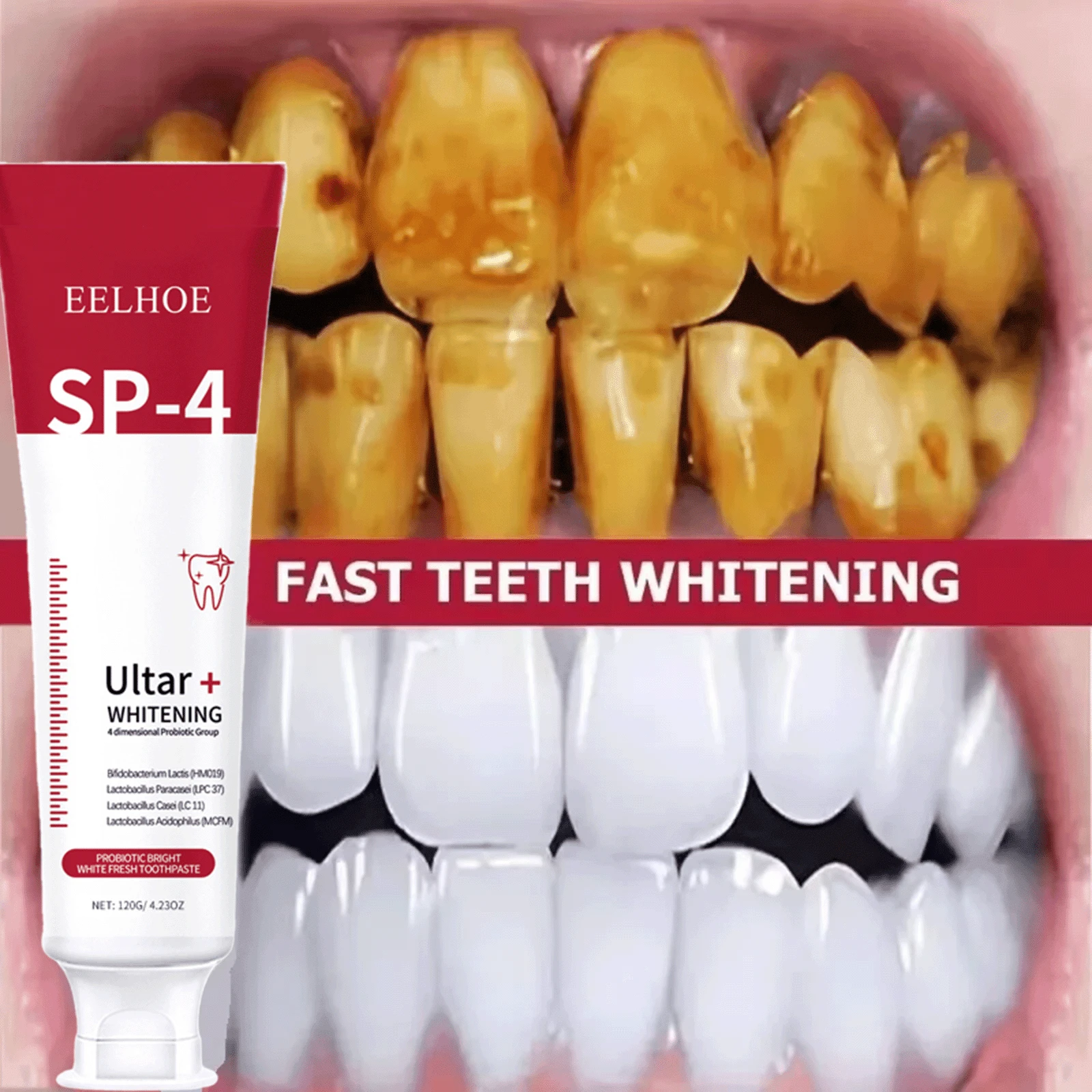 100克益生菌牙膏 - SP-4 牙齿美白、去除牙菌斑、提亮牙齿、口腔清洁、清新口气 - 紅色 - 查看 1