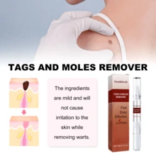 2 Pc Lápiz de piel líquido - eliminador/eliminación física de partículas de carne/removedor de verrugas/eliminación no invasiva, Diseño Compacto, Cuidado del Pie - Para Hombres y Mujeres, Aplicación Fácil - Rojo - Ver 8