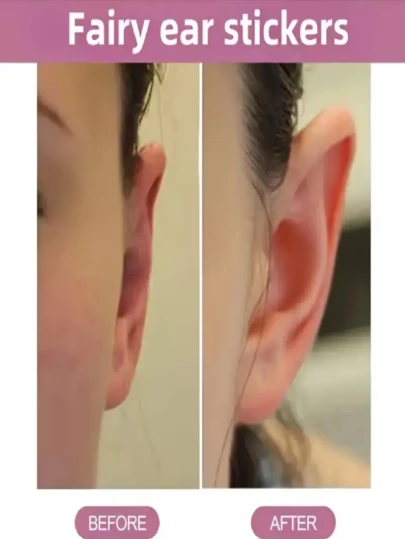 66pcs Matte Ear Stickers - Realistic Ear Shapes, Matte Finish, For Cosplay, Halloween, Everyday - Easy Application & Removal, Non-Irritating Adhesive - Perfect For Parties, Photoshoots, Theater - Unisex Facial Decoration, Halloween Costumes, Seamless Blend, Skinfriendly Material, Costume Accessories, Cosplay Enthusiasts, Ear Wax Removal Tool, Ear Wax Remover, Ear Wax Cleaner, Ear Wax Puller, Elf Ear Tape