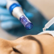 20支Dr.O Pen针头，兼容Ultima M8、M8S、M7S、A10、A6 - 100%原装Dr.Pen A8S M8S A9针头 - 适用于痤疮疤痕、凹陷疤痕、妊娠纹、米诺地尔、微针滚轮、美容、护肤产品、SPA、自我护理、护肤工具、面部护理、美容师用品、按摩、面部按摩工具、面部滚轮 - 彩色 - 查看 32