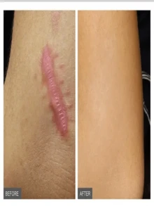 这款富含胶原蛋白的面霜旨在紧致肌肤并提供深层补水，适合所有肤质。这款保湿霜含有肽，是理想的护肤之选。 - 彩色 - 查看 3