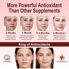 Gwynne Astaxantina 12 Mg,astaxantina Antioxidant From Fresh Haematococcus Pluvialis,apoya La Salud Ocular, Articular Y Cutánea,120 Cápsulas - Otros - Ver 6