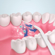 Irrigador bucal eléctrico portátil, con limpieza multiángulo para el cuidado bucal diario y la higiene interdental. Tres ajustes de presión de agua se adaptan a diferentes necesidades, mientras que los chorros pulsados de alta presión eliminan eficazmente la placa. Su diseño compacto garantiza una fácil portabilidad. - Blanco - Ver 7