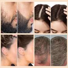 27.5克天然增发纤维，适用于头发稀疏人群，可染色，填充发际线和鬓角，隐形，防汗，持久耐用 - 0.97oz/ 27.5g - 查看 5