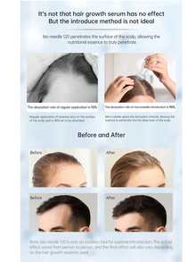 120针不锈钢微针笔，精密设计的针头，可调节针间距，专业微针笔，增强护肤效果，适用于头发/面部/胡须，小巧易用，是任何美容程序的理想之选，男女皆宜。