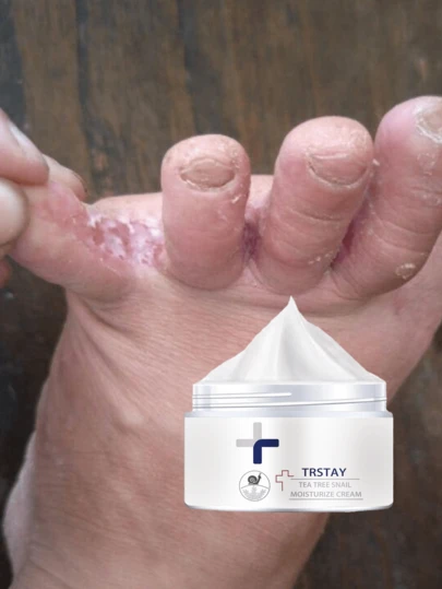 Whitening Foot Scrub Cream Oil Free Exfoliating Formula Removes Calluses Hard Skin Deeply Hydrates Prevents Dryness Cracking For Soft Smooth Fragrance Free Feet Moisturizing Care