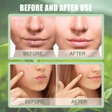 Green Tea Face Masks Stick, Controls Oil, And Deeply Cleanses. Deeply Cleanses And Unclogs Pores, Portable And Mess-Free, Brightens Skin Tone, Travel Essential Face Care Products,Stocking Stuffers For Teens,Christmas Party, Christmas Gifts For Women & Men ,Skin Care - 茶樹 - 查看 5