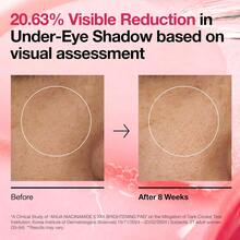 Anua Exfoliating Facial Peels