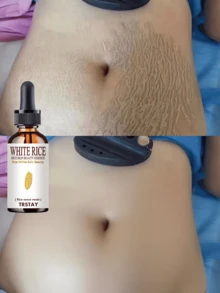 Elastic Moisturizing Essential Oil With Wrinkle Filling Properties To Smooth And Tighten Skin For A Silky Soft Texture Enriched With Nourishing Ingredients For Radiant Healthy Skin - 彩色 - 查看 1