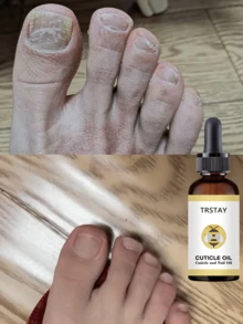 Nail Care Essence Makes Nails Look More Beautiful, With Multiple Specifications Available For Selection. - 彩色 - 查看 6