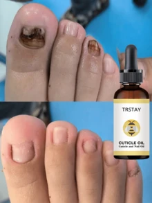 Nail Care Essence Makes Nails Look More Beautiful, With Multiple Specifications Available For Selection. - 彩色 - 查看 1