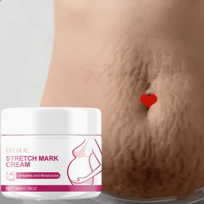 Crema para Estrías en el Embarazo: Manteca Corporal de Nutrición Profunda, Hidratación Profunda para Pieles Delicadas, Antiarrugas y Calmante Natural, Suavidad y Apariencia Impecable. El Regalo Perfecto para Mamá en el Día de la Madre.