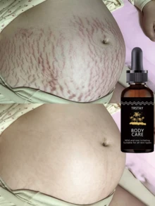 Moisturizing essential oil for delicate skin deep hydration smooth flawless look anti wrinkle natural soothing effect reduce fine lines wrinkles pregnancy stretch marks care - Hyaluronic Acid - Ver 3