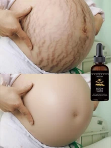 Moisturizing essential oil for delicate skin deep hydration smooth flawless look anti wrinkle natural soothing effect reduce fine lines wrinkles pregnancy stretch marks care - Hyaluronic Acid - Ver 1