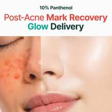 Serums & Facial Treatment - Vitamin C - View 3