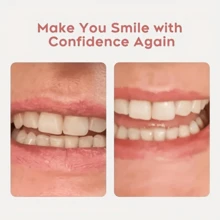 DIY Denture Kit Full Set Of Top & Bottom Fake Teeth For At-Home Smile Enhancement,Crafting Partial Or Full Denture For Comfortable,Easy & Universal Fit - Teeth Color - View 4