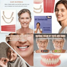 DIY Denture Kit Full Set Of Top & Bottom Fake Teeth For At-Home Smile Enhancement,Crafting Partial Or Full Denture For Comfortable,Easy & Universal Fit - Teeth Color - View 5