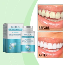 60 Piezas Granulos de Enjuague Bucal con Probióticos, Tabletas de Pasta Dental Sólida Portátiles, Limpieza Eficaz y Elimina Manchas, Ideal para Viajes - Menta - Ver 10