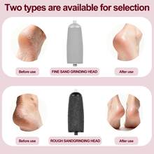 LQT Electric Callus Remover - USB Rechargeable - Painless Callus Removal, Detachable Grinding Head, USB Rechargeable Battery, Unisex, Professional Foot Care Tool (White/Pink) - White - View 11