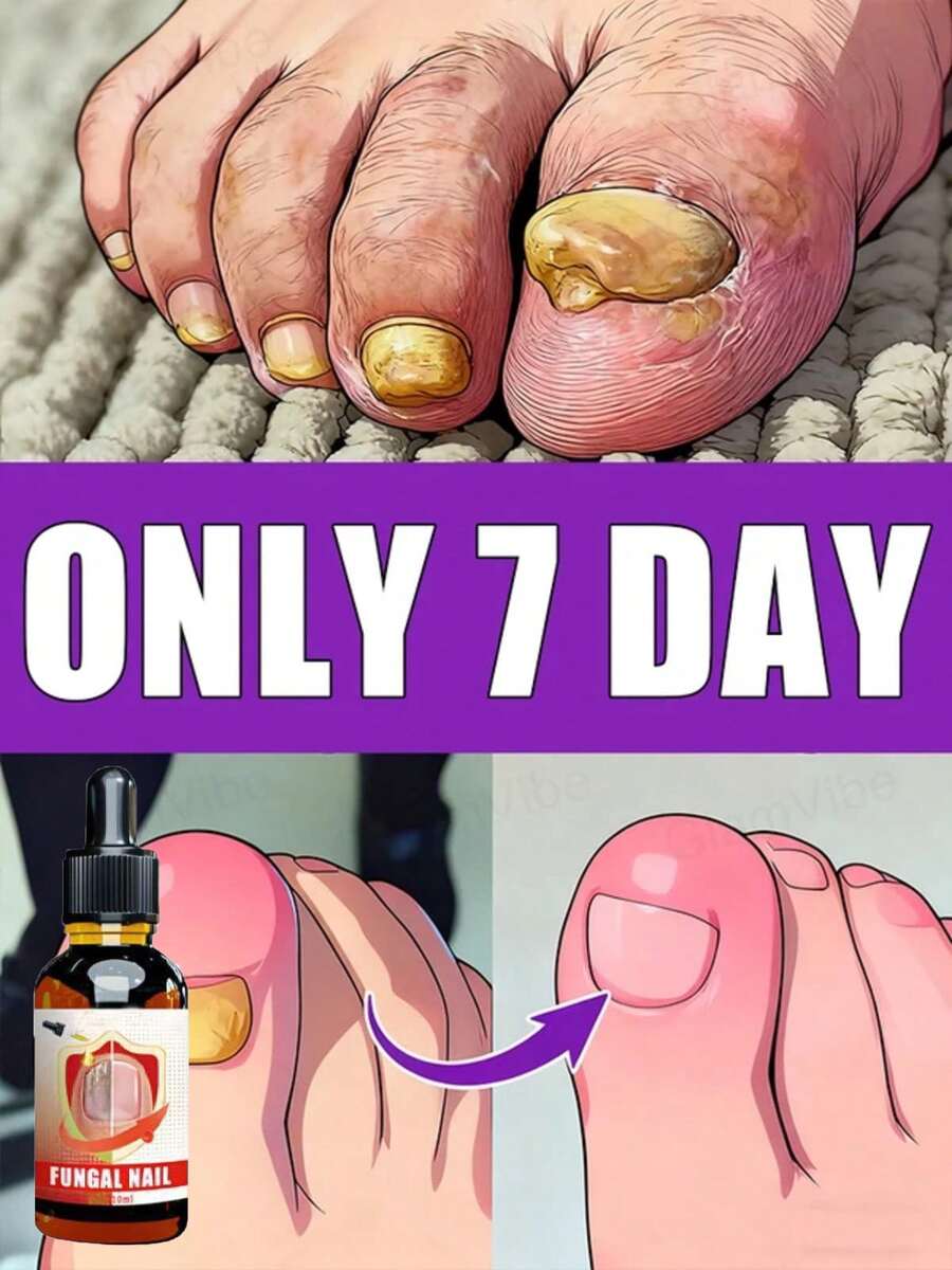 Say Goodbye To Thick Nails, Improve Yellow Nails, Foot Care Tools To Boost Your Confidence.