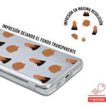 INSTACASE Case Compatible With Oukitel Yorki, Dog Pattern Case For Women, Shockproof TPU Case. - 無色 - 查看 2