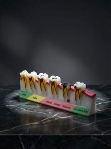 1个牙科模型展示架，牙科解剖教学工具，适用于医学教育辅助和牙科诊所装饰，包含正常、浅、中、深、晚期残余牙根和遗传牙阶段的牙科结构模型，科学教育用品，牙科教学演示模型 - 彩色 - 查看 2