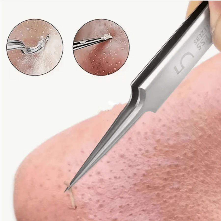 1 PC Ultra Fine No.5 Acne And Blackhead Tweezers - Facial Beauty Removal Tool - Silver - View 1