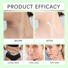 Body Scrub Gel: Deeply Cleanses, Moisturizes, Gently Exfoliates, Removes Dead Skin, And Cleanses Pores. - Gel tẩy tế bào chết - Xem 6