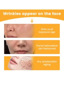 30/10pcs Smile Line Patches, Alcohol-Free, Suitable For All Skin Types, Adult Care, Lifting & Skincare Tool, Facial Care, Beautician Supplies, Massage, Facial Massage Tool, Facial Roller - Multicolor - View 5