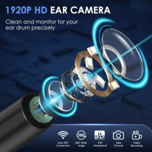 Ear Wax Removal Kit WiFi Ear Cleaner 1920P FHD Ear Camera, Piercing Kit Ear Cleaning Kit Tools Ear Cleaner Ear Wax Remover With 8 PCS Ear Cleaning Kit,Ear Scope Otoscope With 6 LED Lights,Silicone Ear Wax Removal Tool For IOS & Android (Black) - 黑色的 - 查看 4