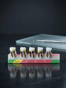 1个牙科模型展示架，牙科解剖教学工具，适用于医学教育辅助和牙科诊所装饰，包含正常、浅、中、深、晚期残余牙根和遗传牙阶段的牙科结构模型，科学教育用品，牙科教学演示模型 - 彩色 - 查看 4