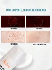 Avene Avène 控油精華液，正裝 30ml，試用裝 5ml，溫和配方，清爽輕盈質地，不油膩，舒緩泛紅，修復肌膚屏障，日常使用 - 雅漾控油抗痘修護精華露 - 查看 10
