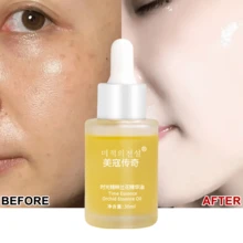 1 chai tinh chất làm sáng da Niacinamide, serum chống lão hóa, tinh dầu chiết xuất hoa lan 30ml, dưỡng ẩm sâu, chống lại các dấu hiệu lão hóa sớm, làm mờ nếp nhăn và vết chân chim, làm săn chắc da, cải thiện tình trạng da xỉn màu và làm sáng da, món quà chăm sóc da tuyệt vời dành cho bạn gái hoặc Ngày của Mẹ. - Màu vàng - Xem 2