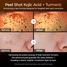 Dr.Melaxin Peel Shoot - Exfoliating Konjic Acid Turmeric Serum 80ml - Facial Exfoliant - Collagen - 查看 4