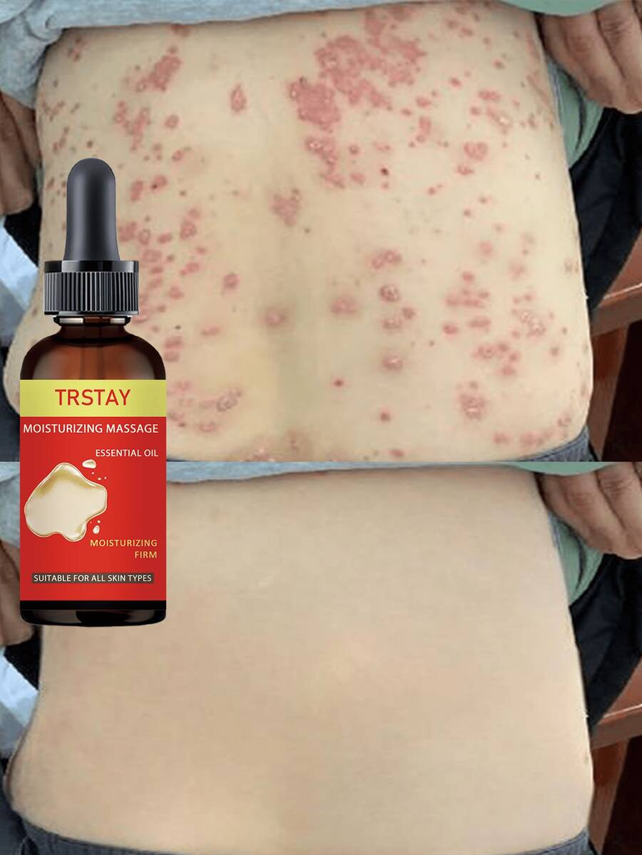 Natural Essential Oil For Soft Smooth Skin Alcohol Free Strong Moisturizing Quick Absorption Formula Daily Care With Organic Ingredients Hydrating Nourishing Treatment - 多色的 - 查看 1